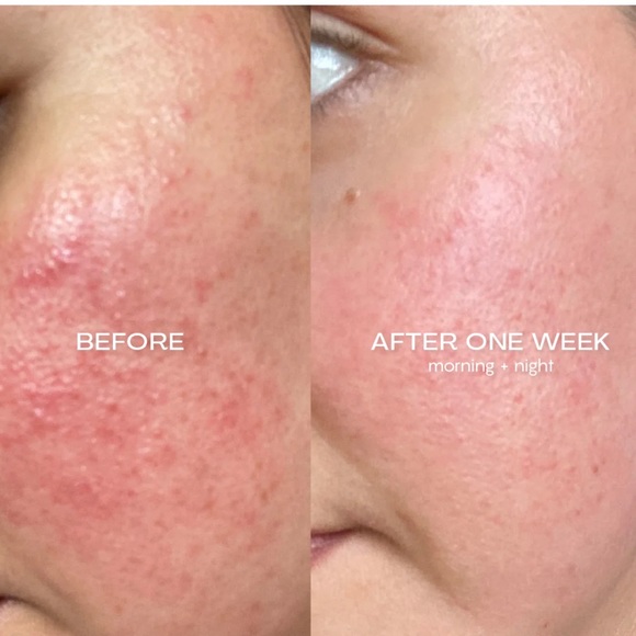 Jess Beauty Face Reset Cleanser + Shine Bright Serum - Picture 2 of 7